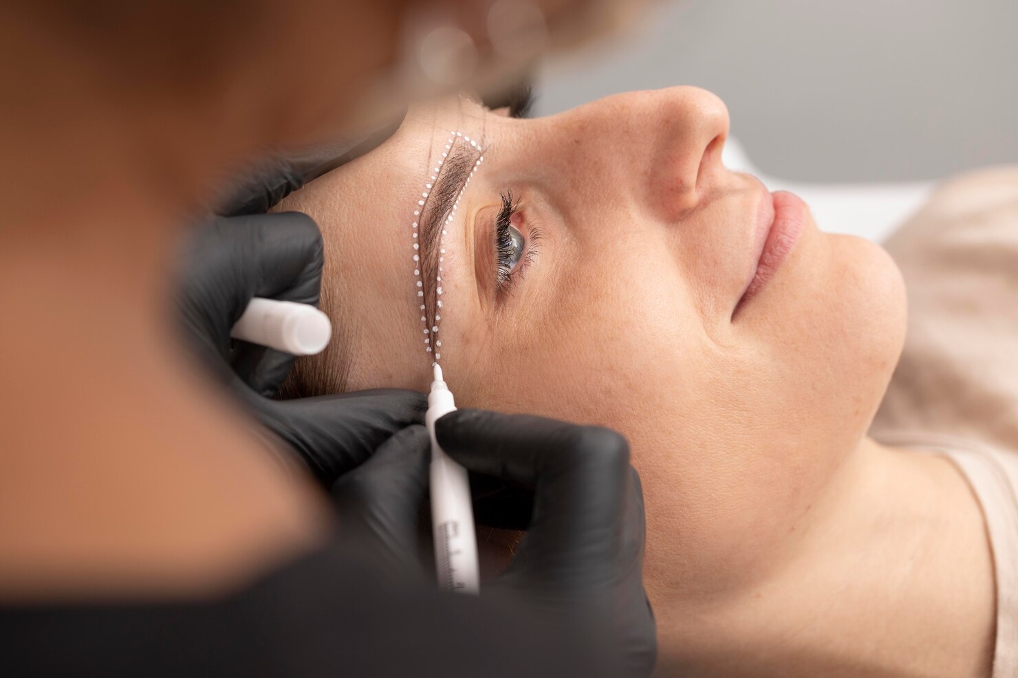 Eyebrow Transplant