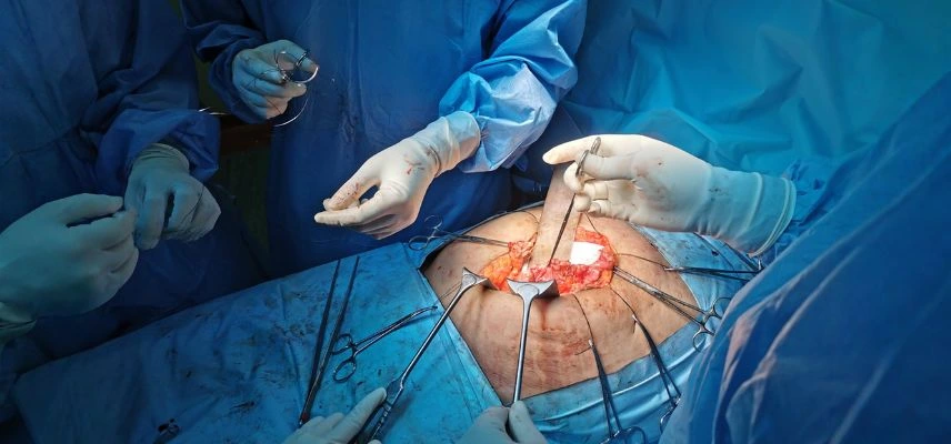 General Surgery Patna