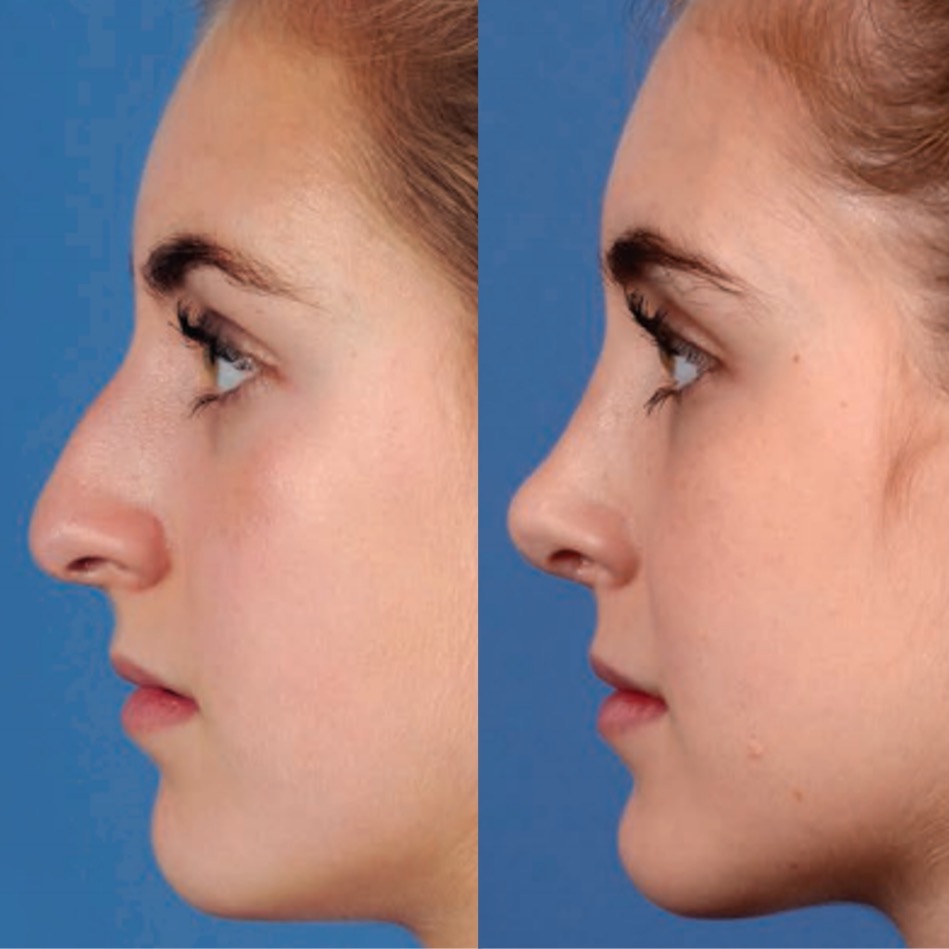 Plastic Surgery Patna