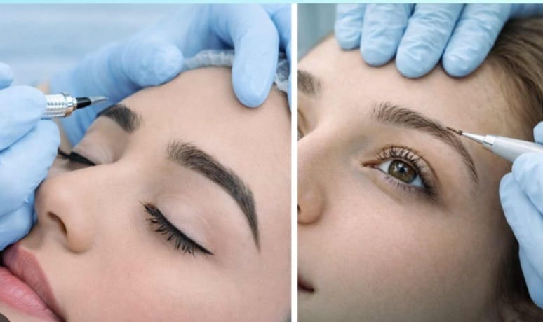 Eyebrow Transplant